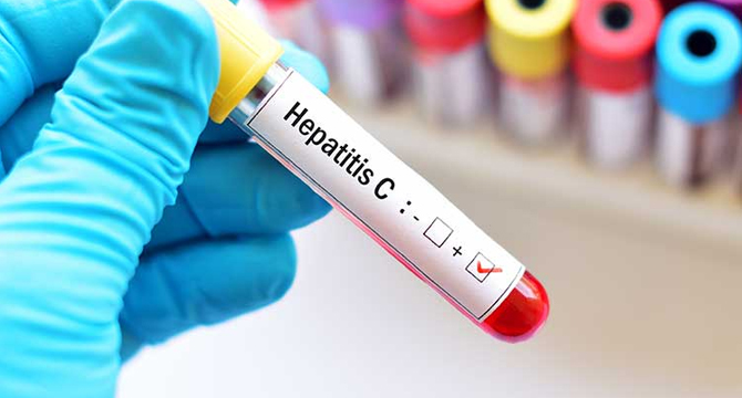 Безплатни прегледи за хепатит В и С от 29 юли до 5 август